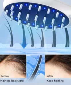 Electric Hair Growth and Scalp Health Massage Comb with Red/Blue Light Therapy
